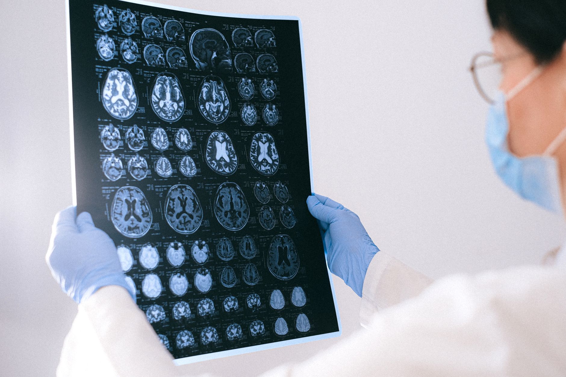 Lekarz analizuje skany MRI mózgu na monitorach w gabinecie