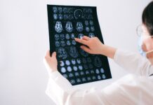 AI w diagnostyce obrazowej: praktyczne zastosowania, korzyści dla pacjenta i wyzwania etyczne Lekarz analizuje skany MRI mózgu na monitorze w szpitalu