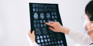 Lekarz analizuje skany MRI mózgu na monitorze w szpitalu