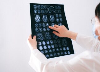 AI w diagnostyce obrazowej: praktyczne zastosowania, korzyści dla pacjenta i wyzwania etyczne Lekarz analizuje skany MRI mózgu na monitorze w szpitalu
