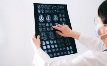 Lekarz analizuje skany MRI mózgu na monitorze w szpitalu