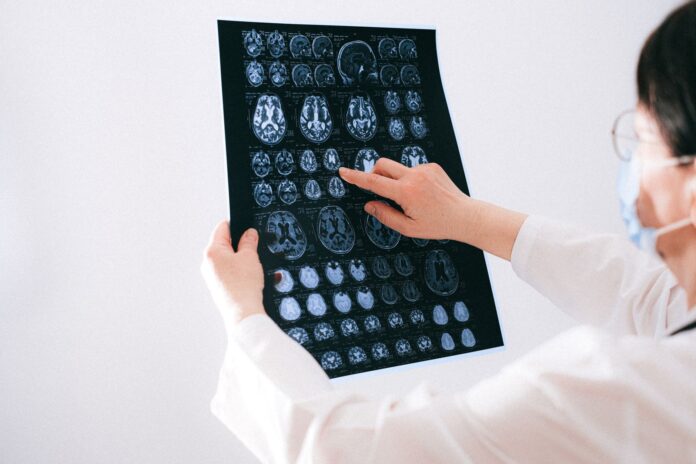 Lekarz analizuje skany MRI mózgu na monitorze w szpitalu Lekarz analizuje skany MRI mózgu na monitorze w szpitalu